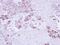 Epoxide Hydrolase 1 antibody, GTX109360, GeneTex, Immunohistochemistry paraffin image 