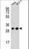 Cytochrome C1 antibody, LS-C167199, Lifespan Biosciences, Western Blot image 