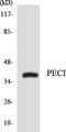 Enoyl-CoA Delta Isomerase 2 antibody, LS-C200478, Lifespan Biosciences, Western Blot image 