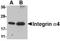 CD49D antibody, TA306654, Origene, Western Blot image 