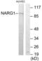 N-alpha-acetyltransferase 15, NatA auxiliary subunit antibody, LS-B9999, Lifespan Biosciences, Western Blot image 