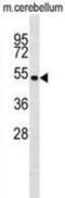 Serine/threonine-protein kinase 11 antibody, abx029442, Abbexa, Western Blot image 