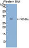 Cadherin-16 antibody, LS-C293080, Lifespan Biosciences, Western Blot image 