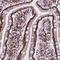 Translocase Of Inner Mitochondrial Membrane 29 antibody, NBP1-94151, Novus Biologicals, Immunohistochemistry frozen image 