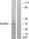 Protein Kinase AMP-Activated Non-Catalytic Subunit Beta 1 antibody, abx014010, Abbexa, Western Blot image 