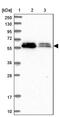 ALG10 Alpha-1,2-Glucosyltransferase antibody, PA5-60328, Invitrogen Antibodies, Western Blot image 