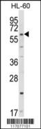 CYP51A1 antibody, 63-681, ProSci, Western Blot image 