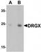 Dorsal Root Ganglia Homeobox antibody, TA320194, Origene, Western Blot image 