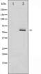 MDM2 Proto-Oncogene antibody, orb99444, Biorbyt, Western Blot image 