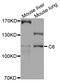 Complement C6 antibody, abx136078, Abbexa, Western Blot image 