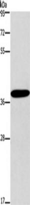 CD192 antibody, TA350635, Origene, Western Blot image 