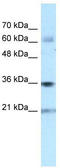 Pim-1 Proto-Oncogene, Serine/Threonine Kinase antibody, TA337681, Origene, Western Blot image 