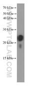 Transgelin antibody, 60213-1-Ig, Proteintech Group, Western Blot image 