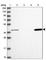 Sorbitol Dehydrogenase antibody, HPA040260, Atlas Antibodies, Western Blot image 