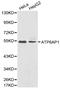 ATPase H+ Transporting Accessory Protein 1 antibody, LS-C192471, Lifespan Biosciences, Western Blot image 