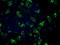 Fumarate Hydratase antibody, TA500681, Origene, Immunofluorescence image 