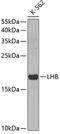 Luteinizing Hormone Beta Polypeptide antibody, GTX33295, GeneTex, Western Blot image 