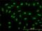 RB Binding Protein 4, Chromatin Remodeling Factor antibody, H00005928-M01, Novus Biologicals, Immunofluorescence image 