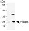 Prostaglandin D2 Synthase antibody, NB110-59911, Novus Biologicals, Western Blot image 