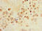 Solute Carrier Family 30 Member 8 antibody, orb46443, Biorbyt, Immunohistochemistry paraffin image 