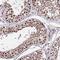 Zinc Finger BED-Type Containing 4 antibody, HPA045341, Atlas Antibodies, Immunohistochemistry frozen image 