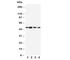 Dopamine Receptor D3 antibody, R30661, NSJ Bioreagents, Western Blot image 