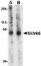 SLIT And NTRK Like Family Member 6 antibody, orb74944, Biorbyt, Western Blot image 