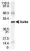 Aurora Kinase A antibody, NBP1-51843, Novus Biologicals, Western Blot image 