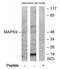 Mitogen-activated protein kinase 6 antibody, TA312049, Origene, Western Blot image 