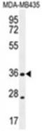 Chemokine XC receptor 1 antibody, AP54581PU-N, Origene, Western Blot image 