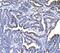 Protein dpy-19 homolog 1 antibody, A16659-1, Boster Biological Technology, Immunohistochemistry paraffin image 