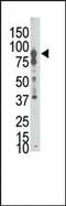 HEP antibody, MBS9211922, MyBioSource, Western Blot image 