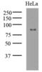 Histone acetyltransferase KAT2A antibody, GTX50005, GeneTex, Western Blot image 