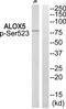 Arachidonate 5-lipoxygenase antibody, TA326065, Origene, Western Blot image 