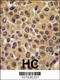 Cell Division Cycle 25B antibody, 62-765, ProSci, Immunohistochemistry paraffin image 
