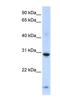 Zinc Finger Protein 138 antibody, NBP1-79234, Novus Biologicals, Western Blot image 