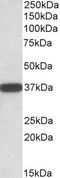 Cytochrome B5 Reductase 3 antibody, STJ72489, St John