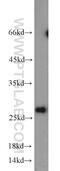 Syntaxin Binding Protein 6 antibody, 10976-4-AP, Proteintech Group, Western Blot image 