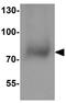 NADPH Oxidase 3 antibody, GTX31931, GeneTex, Western Blot image 