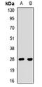 SBDS Ribosome Maturation Factor antibody, orb412393, Biorbyt, Western Blot image 