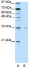 Forkhead Box Q1 antibody, TA345477, Origene, Western Blot image 