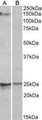 RNA Binding Motif Protein 20 antibody, MBS422508, MyBioSource, Western Blot image 
