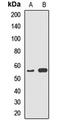 Thromboxane A Synthase 1 antibody, LS-C668052, Lifespan Biosciences, Western Blot image 