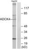 Uncharacterized aarF domain-containing protein kinase 4 antibody, abx013756, Abbexa, Western Blot image 