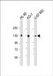 DEP Domain Containing 5 antibody, PA5-71618, Invitrogen Antibodies, Western Blot image 