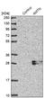 Amelotin antibody, NBP2-32718, Novus Biologicals, Western Blot image 