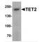 Methylcytosine dioxygenase TET2 antibody, TA349032, Origene, Western Blot image 
