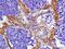 Formin Homology 2 Domain Containing 1 antibody, GTX51345, GeneTex, Immunohistochemistry paraffin image 