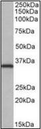 NIMA Related Kinase 7 antibody, orb96449, Biorbyt, Western Blot image 