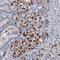 Fibroblast growth factor receptor 2 antibody, NBP1-88670, Novus Biologicals, Immunohistochemistry frozen image 